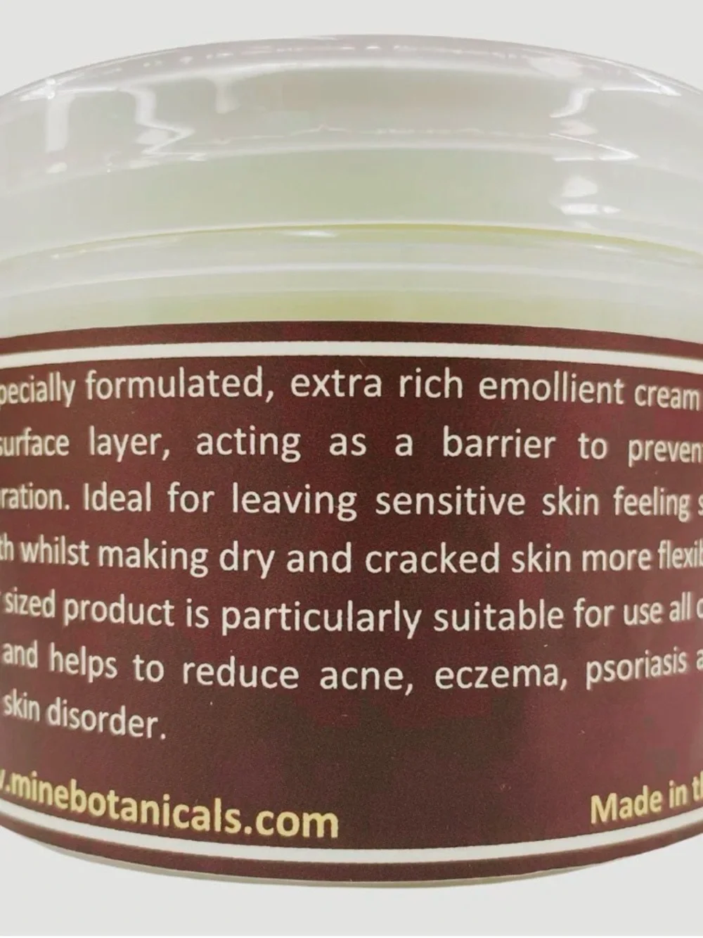 Yellow Whipped Shea Butter for Acne & Eczema